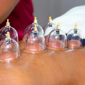 Cupping  with massage (90min)